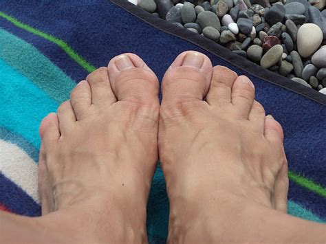 gross feet pictures|375 Images Of Ugly Feet Stock Photos & High